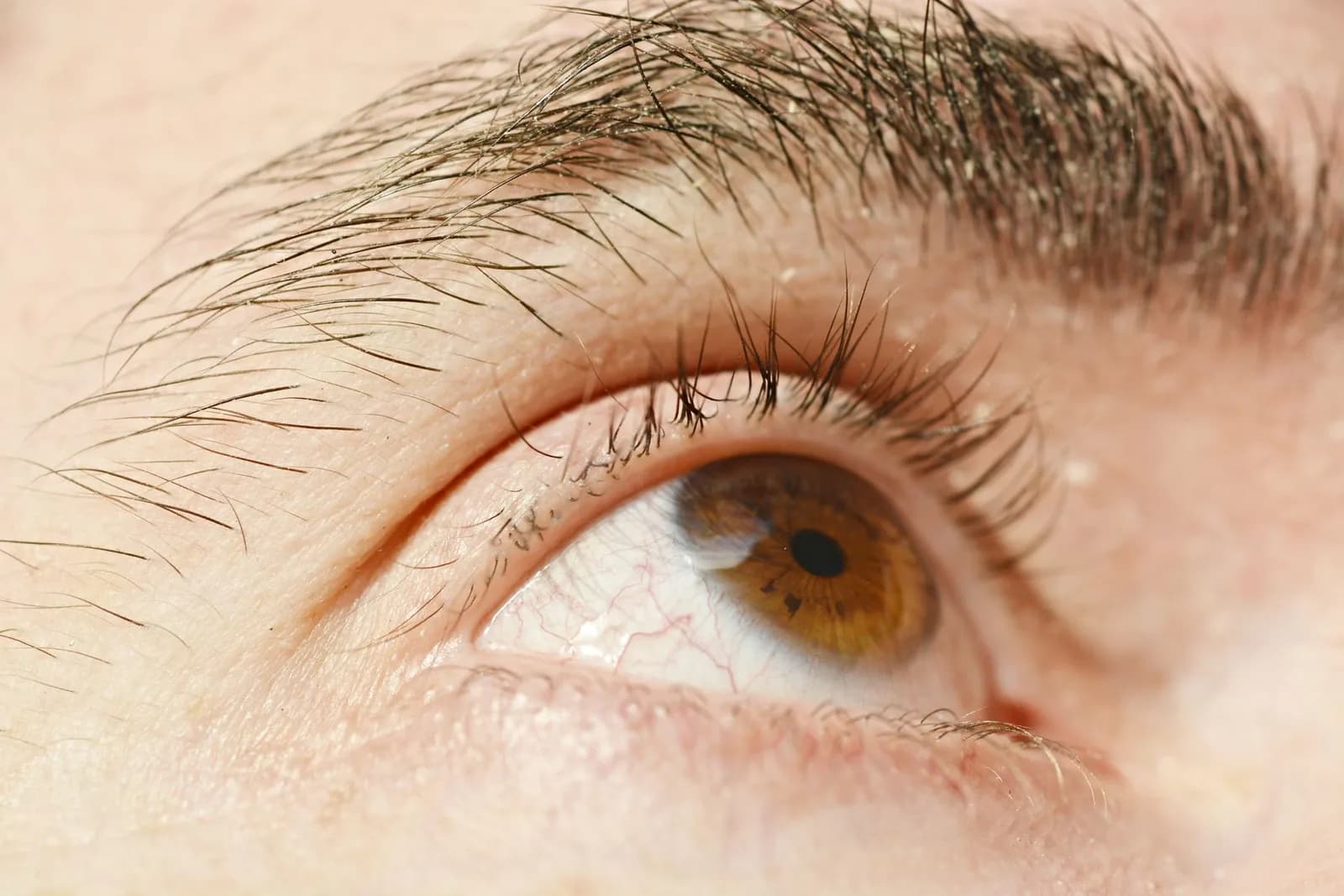 Close-up of an eye and its surface